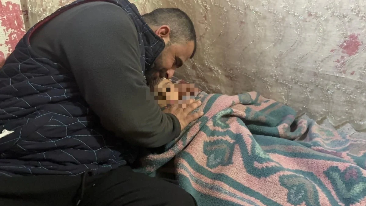 Kayseri'de köpek saldırısında yaralanan 3 yaşındaki bebek, 5 operasyon atlattı