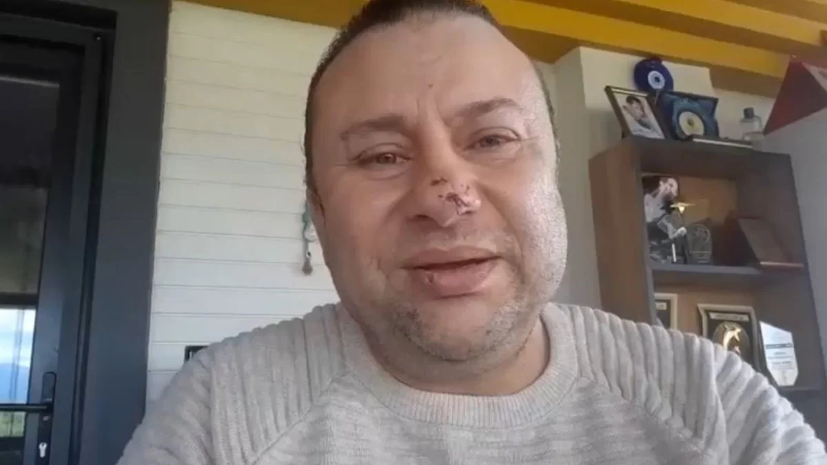 Pitbull saldırısında hastanelik olan Onur Akay o anları anlattı