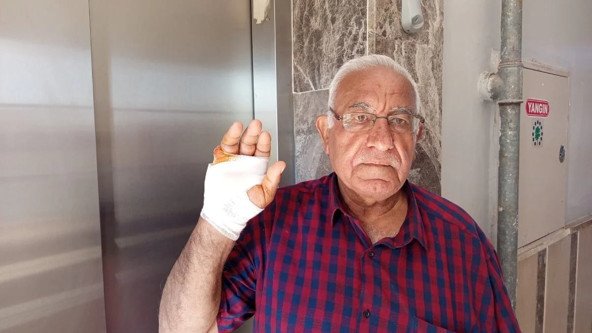 Hatay'da komşusu tarafından parmağı ısırılan adamın parmağı ampute edildi